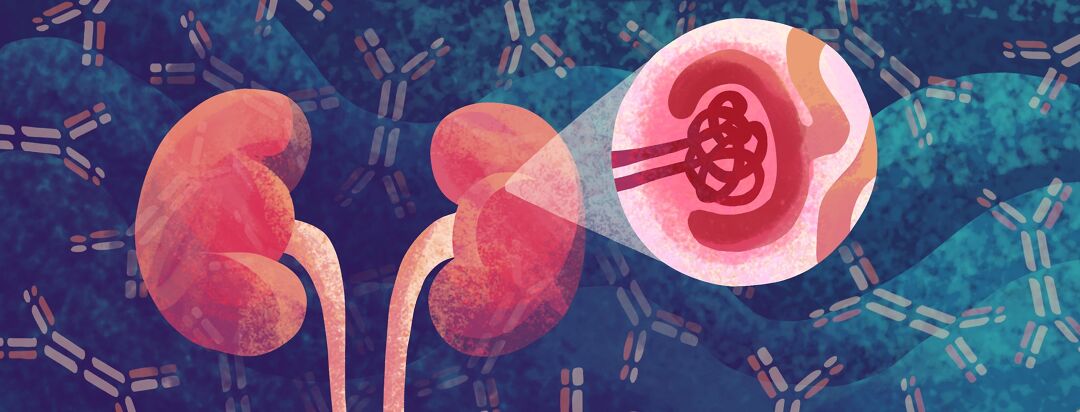 What Is IgA Nephropathy? image